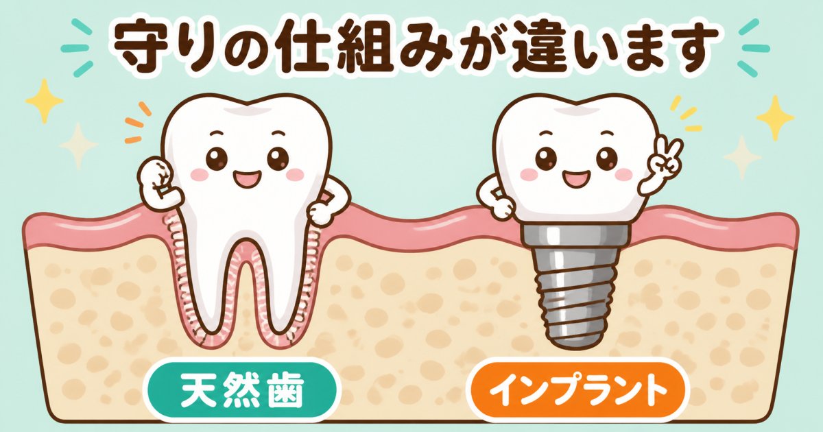 インプラント周囲炎とは？天然歯の歯周病との違いと進行の仕組み